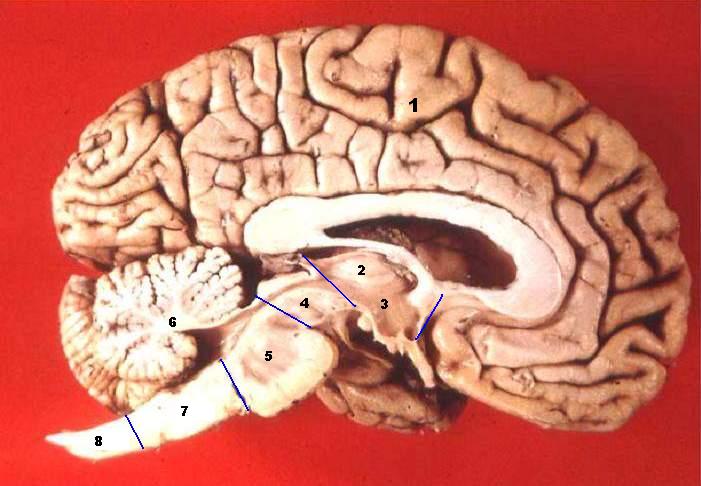 The four major brain regions in midsagittal section