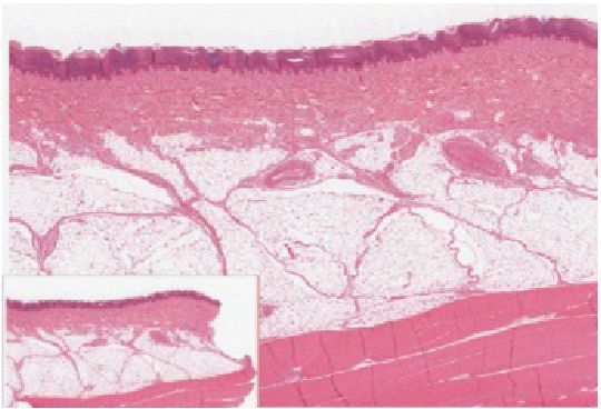 The five layers of the epidermis, stacked from deep to surface