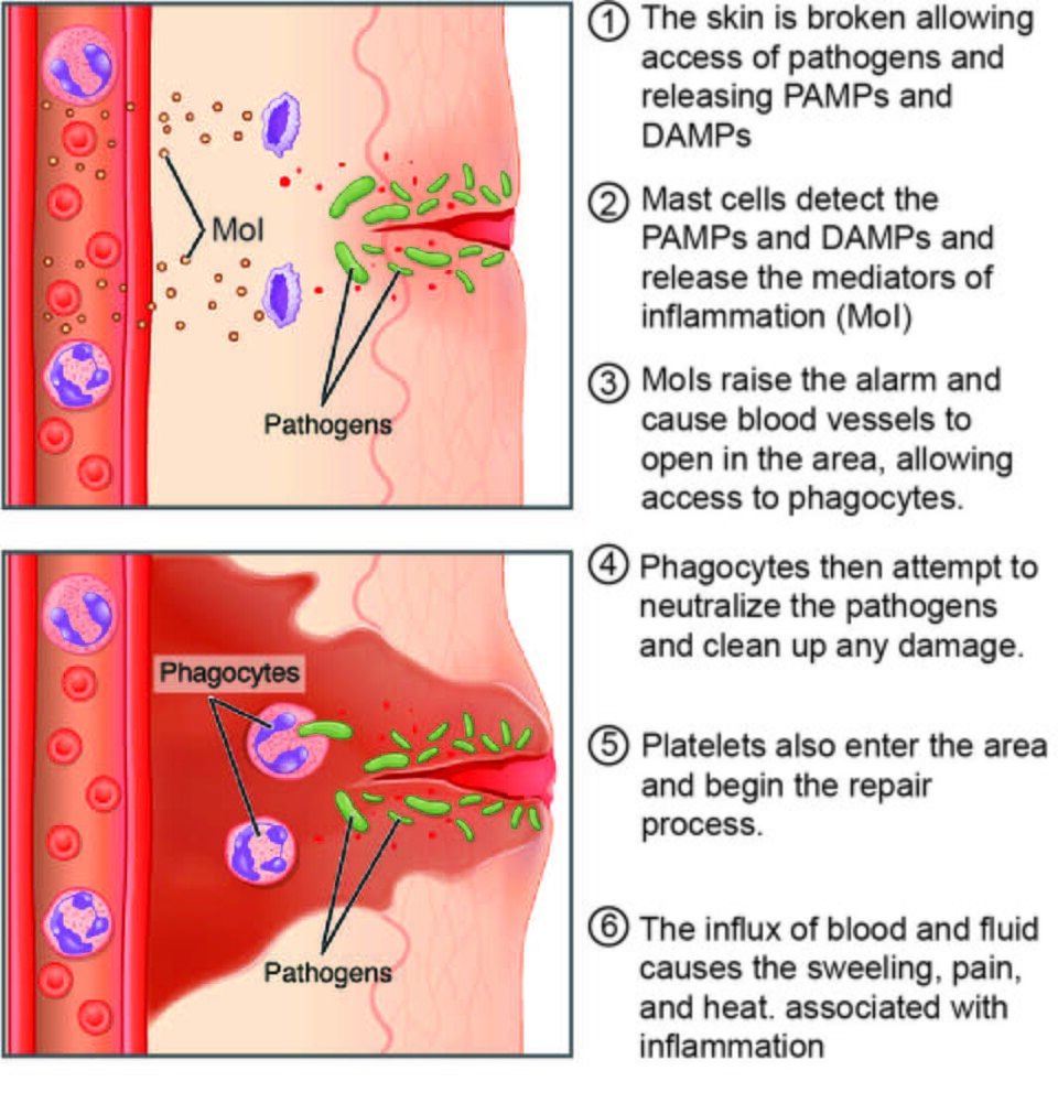 The steps of the inflammatory response