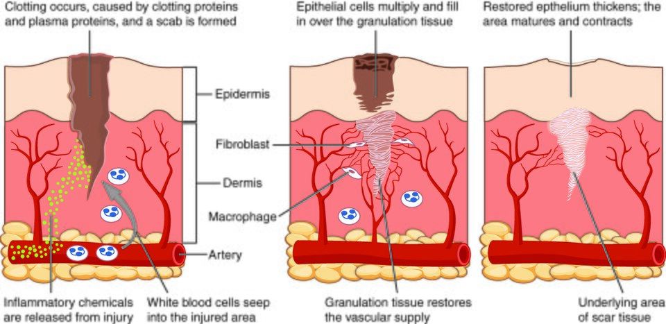 The stages of tissue repair reference figure