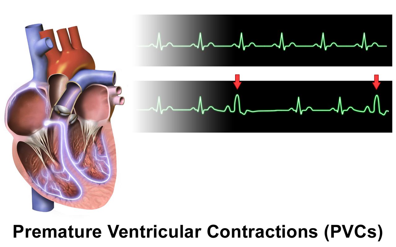 Cardiotocograph tracing showing the fetal heart rate baseline with variability above a contraction channel