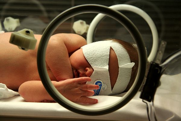 Phototherapy converts unconjugated bilirubin in the skin into water-soluble isomers that can be excreted without hepatic conjugation.
