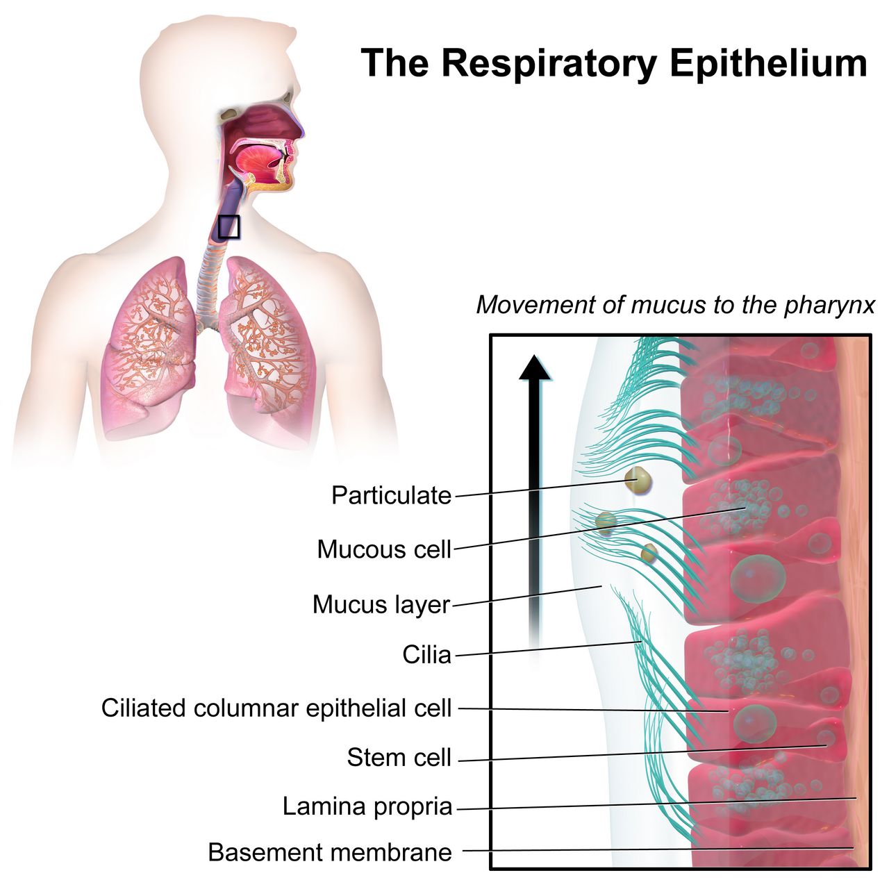 Diagram of the lower respiratory tract showing bronchi, bronchioles and alveoli with a cross-section of a narrowed inflamed airway