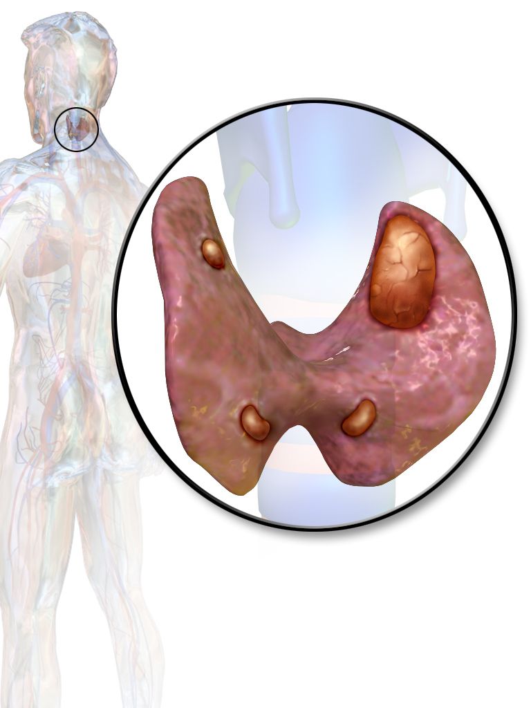 Anatomical illustration of the posterior thyroid gland showing four parathyroid glands embedded on its posterior surface with adjacent recurrent laryngeal nerves