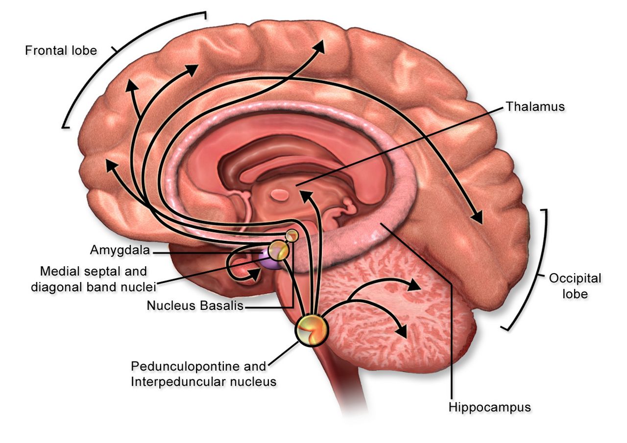 Diagram of the neuromuscular junction showing acetylcholine release, postsynaptic acetylcholine receptors and antibody-mediated receptor loss in myasthenia gravis