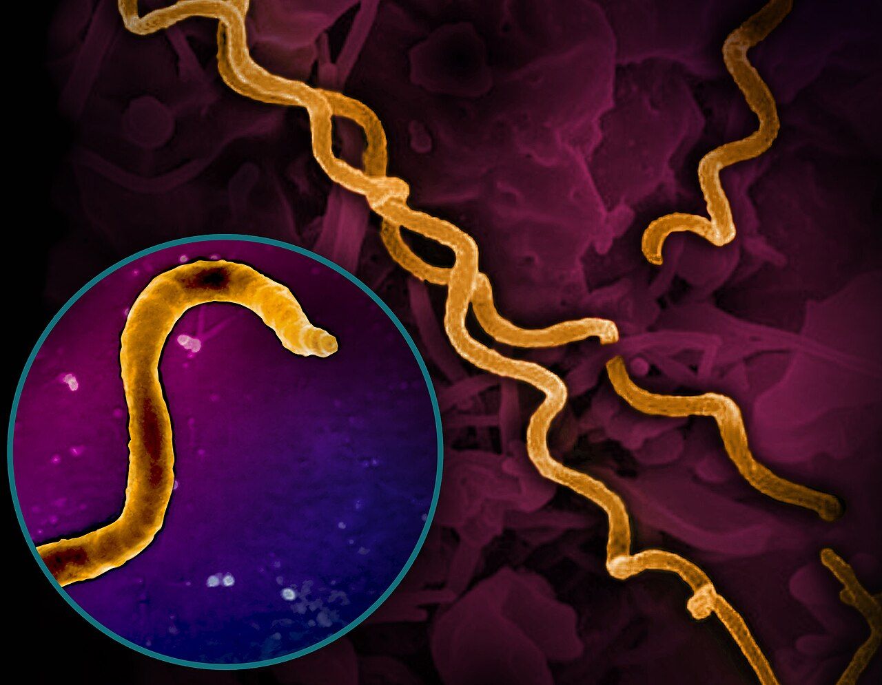 Treponema pallidum, the syphilis spirochete &mdash; an infection whose incidence, including congenital cases, has risen sharply in recent years.
