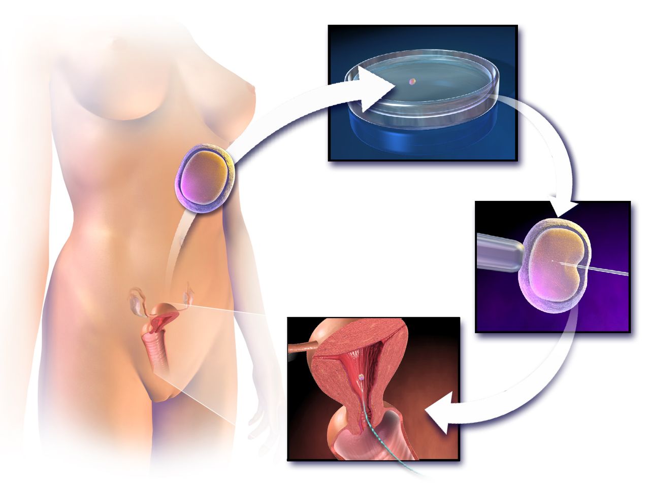 Labeled sagittal anatomical diagram of the male reproductive system showing testis, epididymis, vas deferens, seminal vesicle, prostate gland, bulbourethral gland, urethra, penis and scrotum