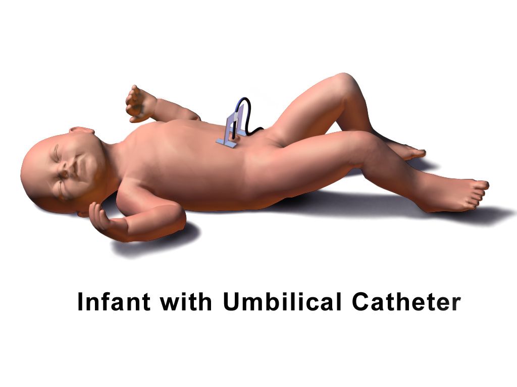 Anatomical illustration of a fetus in utero at term showing the placenta, umbilical cord, amniotic sac and fluid, cervix and vertex cephalic presentation