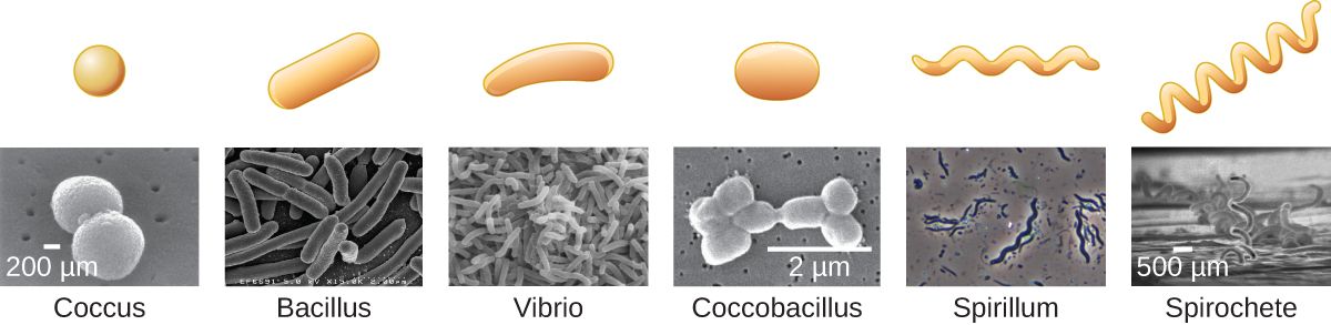 Bacteria viewed under magnification