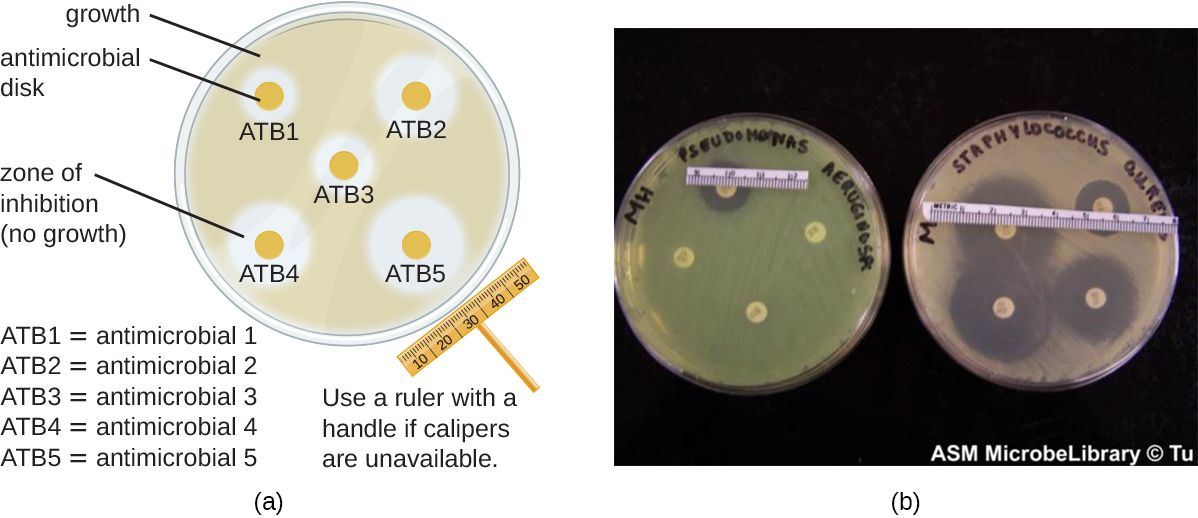 A Kirby-Bauer disk-diffusion plate showing zones of inhibition around antibiotic disks