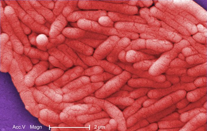 Salmonella bacteria, gram-negative rods, invading cultured cells