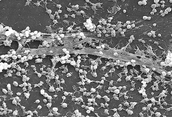 Bacterial adhesins binding to receptors on a host cell surface