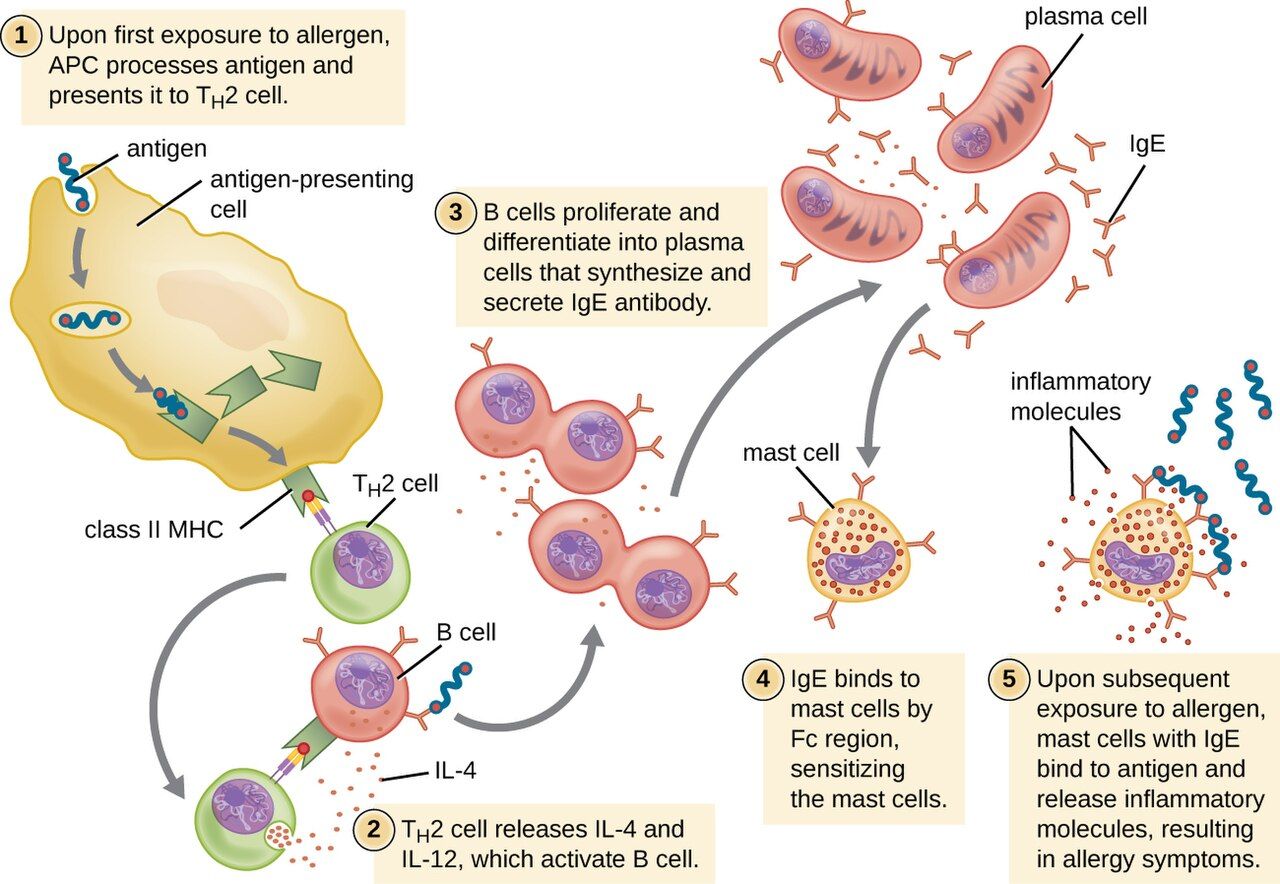 A mast cell degranulating and releasing histamine in a type I reaction