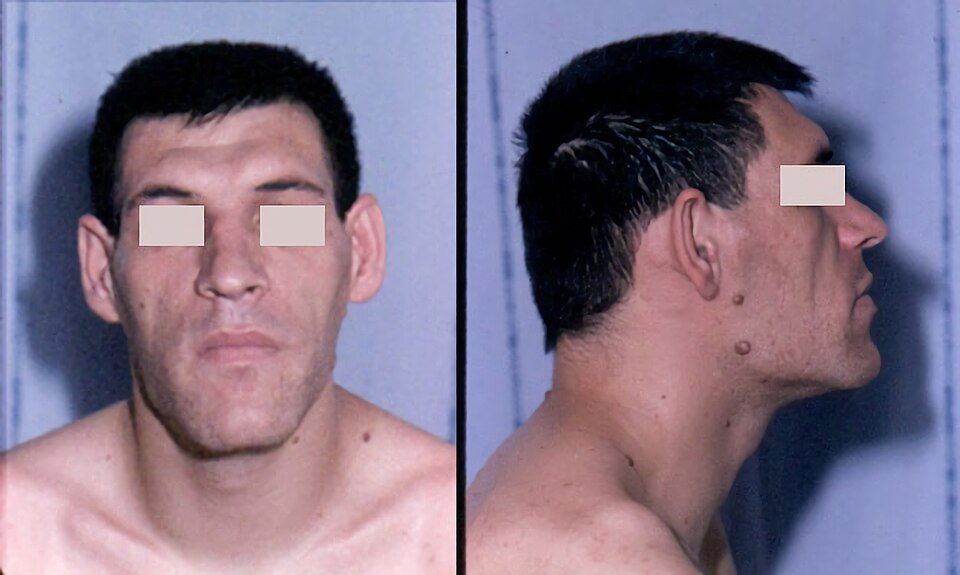 Growth hormone reference figure
