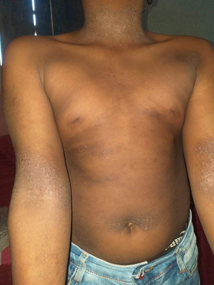 Skin conditions reference figure