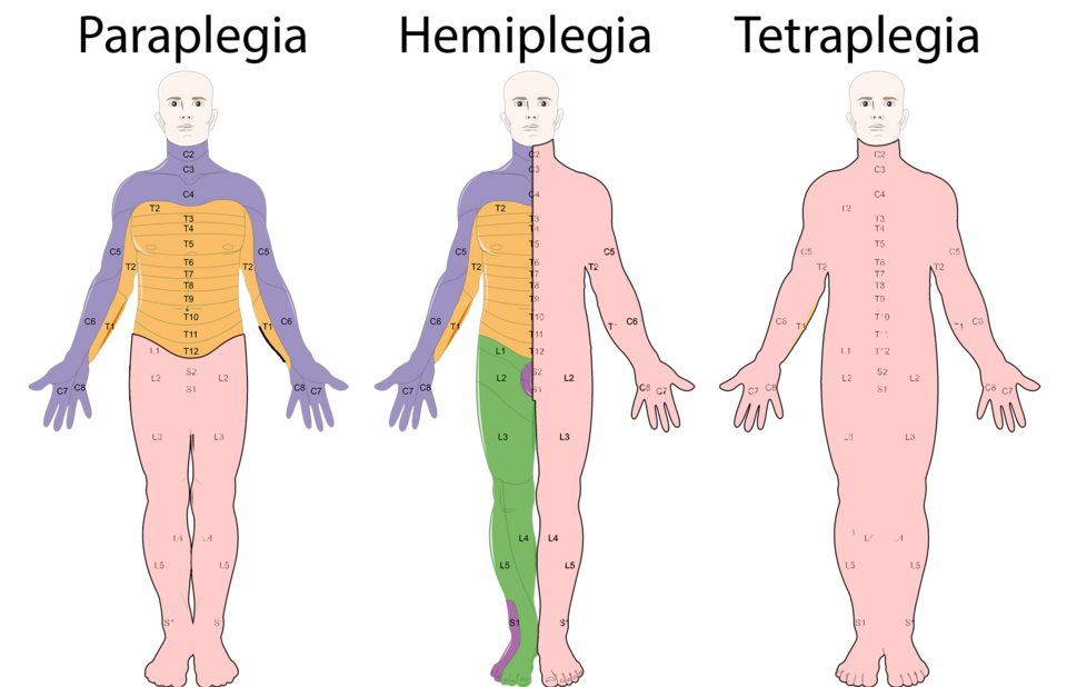 Brain & cord injury reference figure