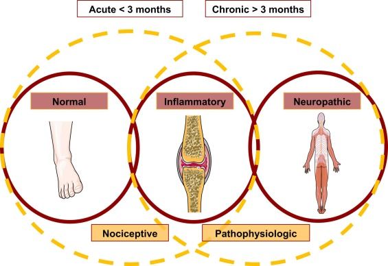 Types of pain reference figure