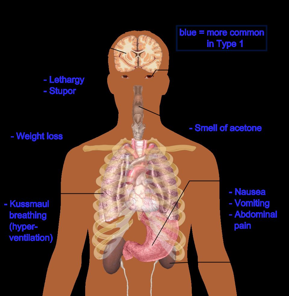 Reference figure for diabetes mellitus