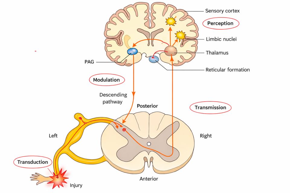 Diagram of the pain pathway from an injury up the spinal cord to the brain