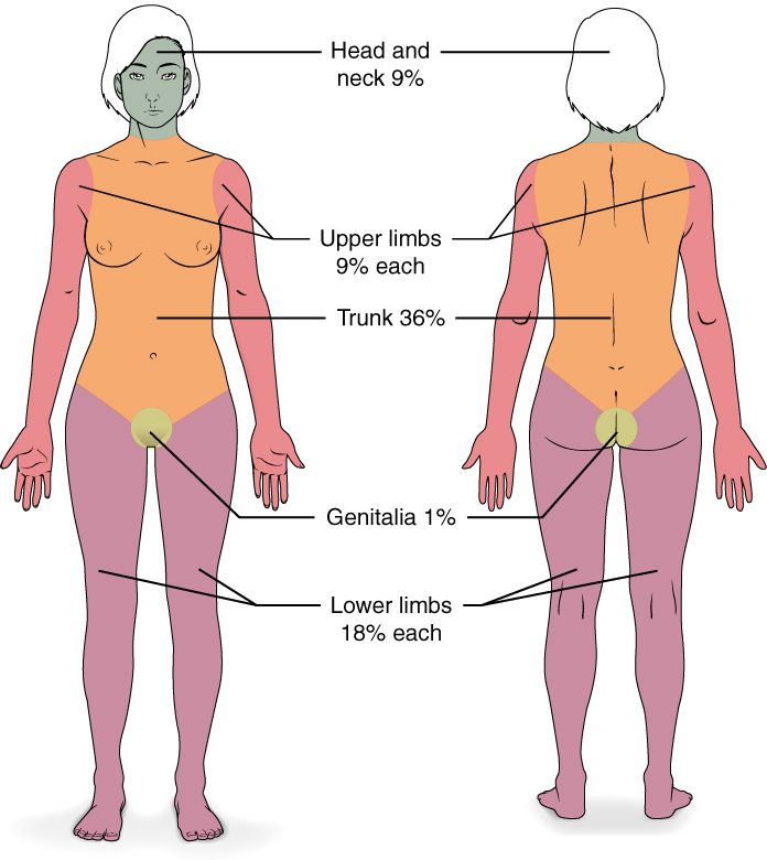Reference figure comparing the depth of first-, second-, and third-degree burns through the skin layers