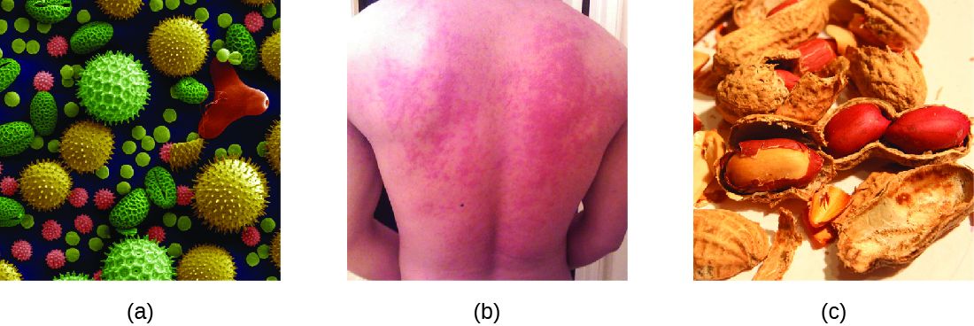 Allergen exposure and mast cell mediator release reference figure